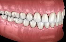 The Science of Dental Occlusion: Understanding Bite Alignment and Correction